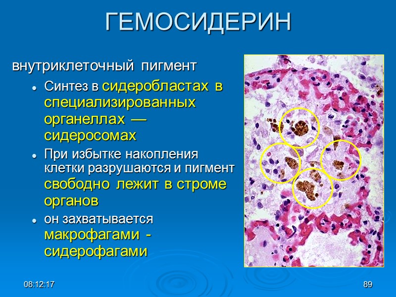 08:12:02 89 ГЕМОСИДЕРИН внутриклеточный пигмент Синтез в сидеробластах в специализированных органеллах — сидеросомах 